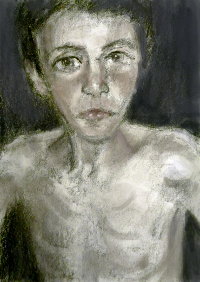 Madaya child2