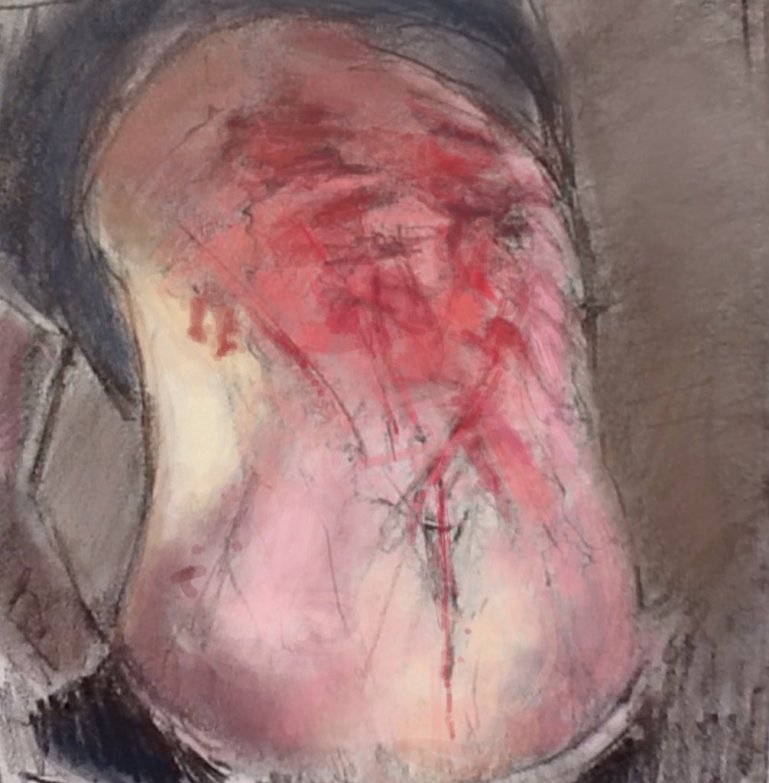 Assad Prison Torture